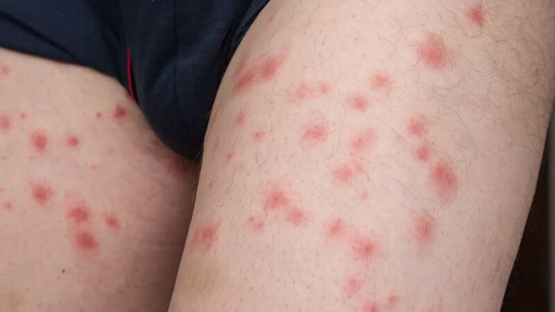 Diet-bo-chet-trong-nha-2